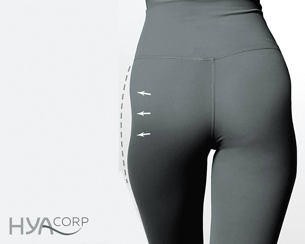 Hip Dips Una conversación con un cirujano plástico